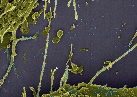 Dois casos da nova variante da Covid-19 em São Paulo são descartados 