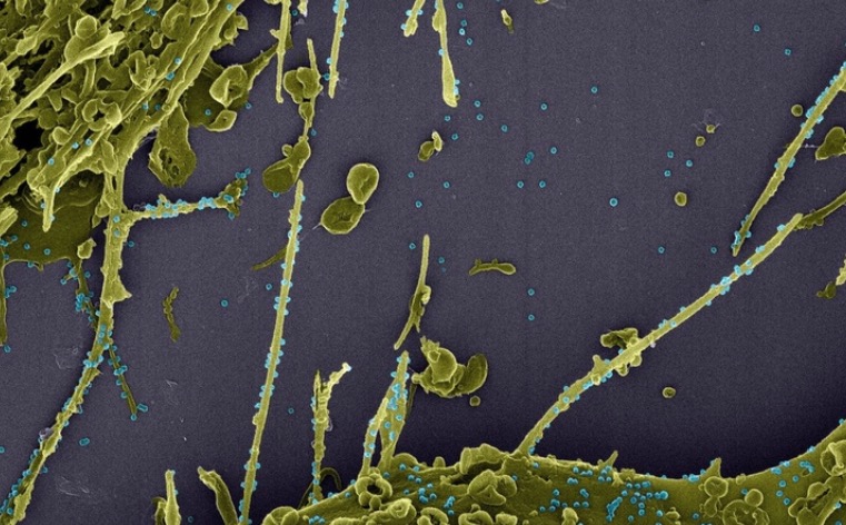 Dois casos da nova variante da Covid-19 em São Paulo são descartados 