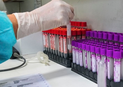 Brasil ultrapassa 142 mil óbitos pela Covid; veja estados mais afetados