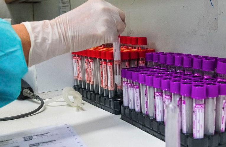 Brasil ultrapassa 142 mil óbitos pela Covid; veja estados mais afetados