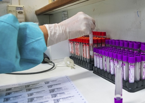 Brasil passa de 138 mil mortes e quase 5 milhões de casos de Covid-19