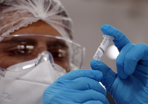 Brasil registra mais de 7 milhões de casos confirmados de Covid-19