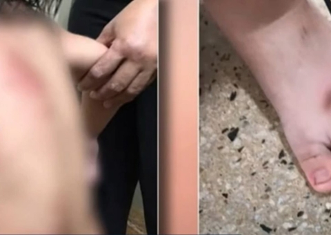 Criança de 2 anos é arrastada por carro da família durante briga dos pais 