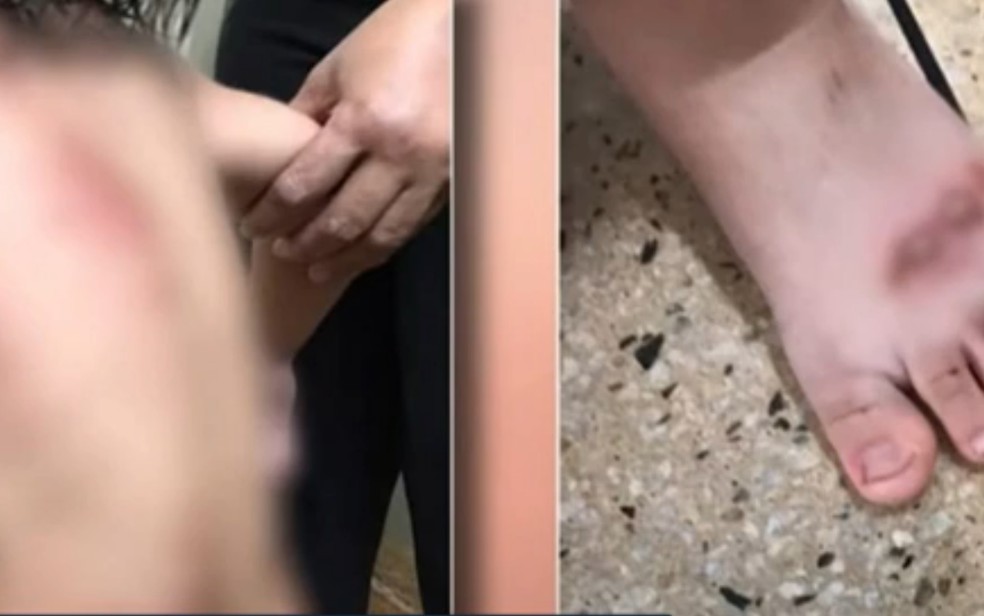 Criança de 2 anos é arrastada por carro da família durante briga dos pais 