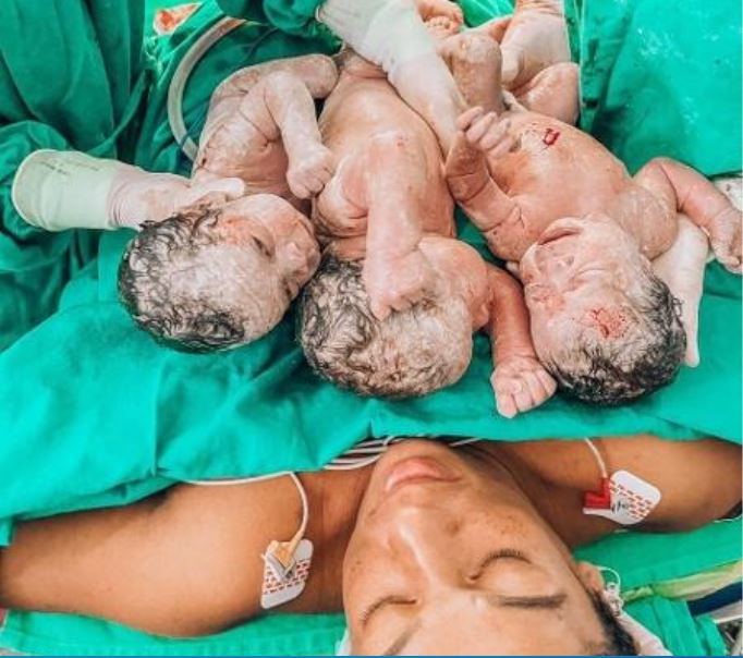 Mulher morre após dar à luz a trigêmeos