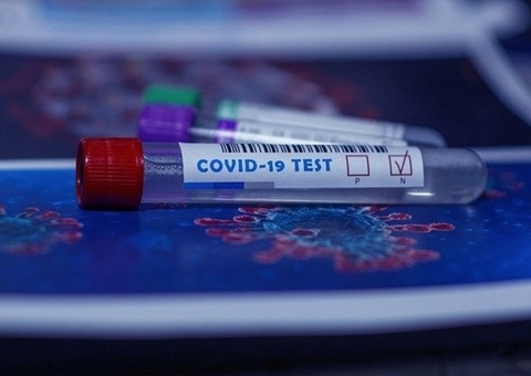 Brasil registra mais de 800 mortes por Covid-19 em 24 horas