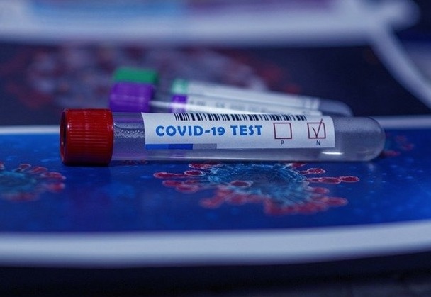 Brasil registra mais de 800 mortes por Covid-19 em 24 horas