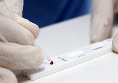 Brasil registra 54.096 novos casos de Covid das últimas 24 horas