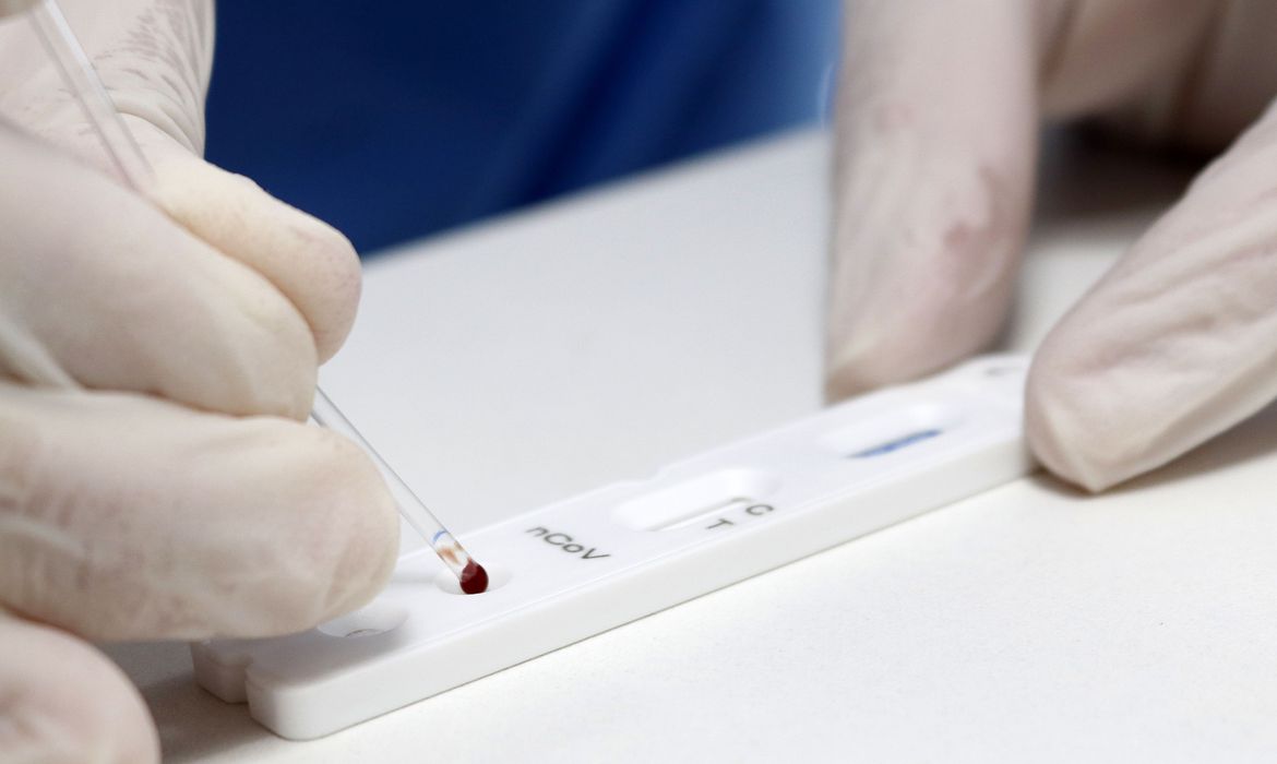 Brasil registra 54.096 novos casos de Covid das últimas 24 horas