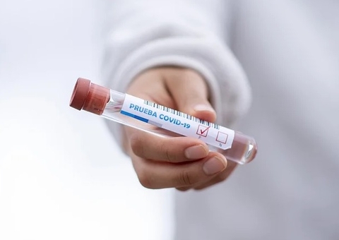 Brasil registra 497 mortes por Covid-19 em 24 horas