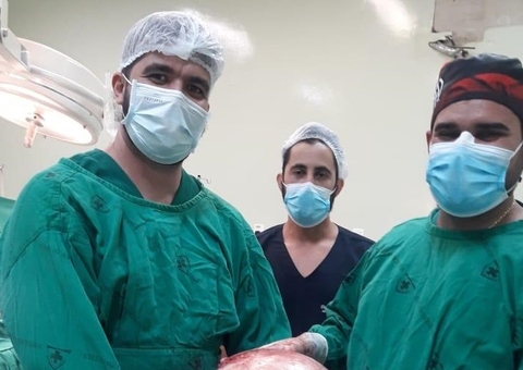 Mulher desconfia de gravidez e descobre tumor de 20kg no ovário; veja foto