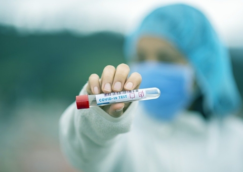 Brasil registra 23.671 novos diagnósticos positivos para Covid em 24hs