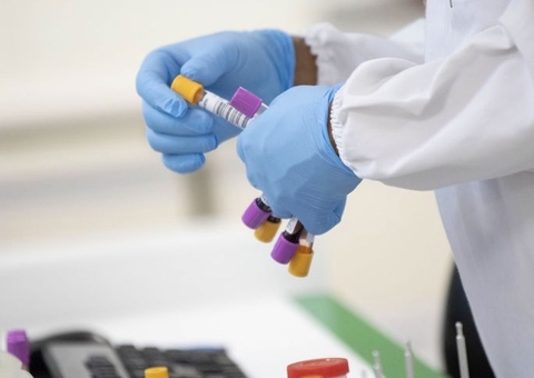 Brasil tem 4,4 milhões de casos e 135 mil mortes por coronavírus