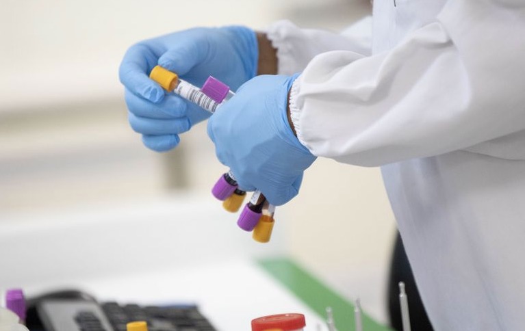 Brasil tem 4,4 milhões de casos e 135 mil mortes por coronavírus