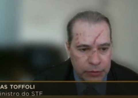 Dias Toffoli surge com cicatrizes no rosto em sessão do STF