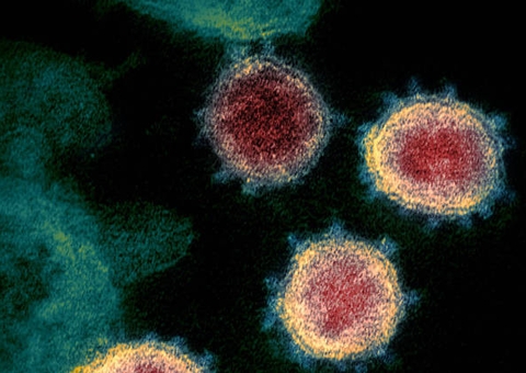 Falta de recursos e insumos no Brasil dificultam identificação de novas variantes do coronavírus