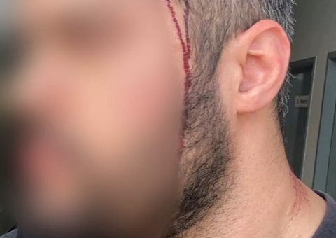 Sobrinho de Bolsonaro é suspeito de bater em rapaz que dormia com ex dele