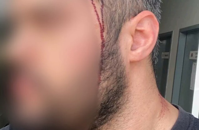 Sobrinho de Bolsonaro é suspeito de bater em rapaz que dormia com ex dele