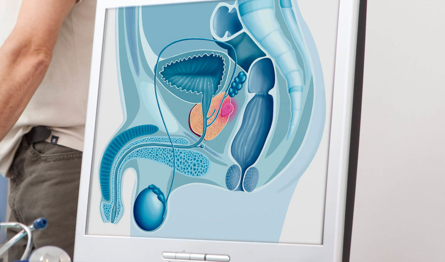 ANS aprova novos tratamentos para câncer de próstata e outras doenças