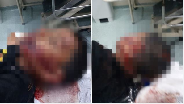 Menino autista é levado para matagal e brutalmente espancado