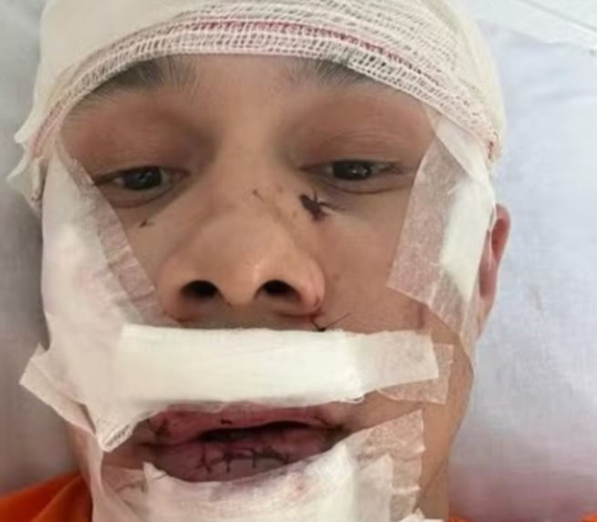 Morador do DF confessa agressão a personal trainer em bar de SP