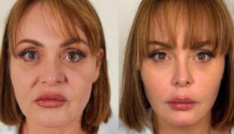 Gaby Spanic surpreende fãs com rejuvenescimento facial; veja antes e depois