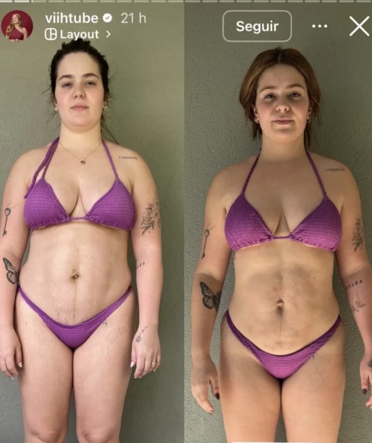 Antes e depois: Viih Tube exibe corpo após série de cirurgias estéticas