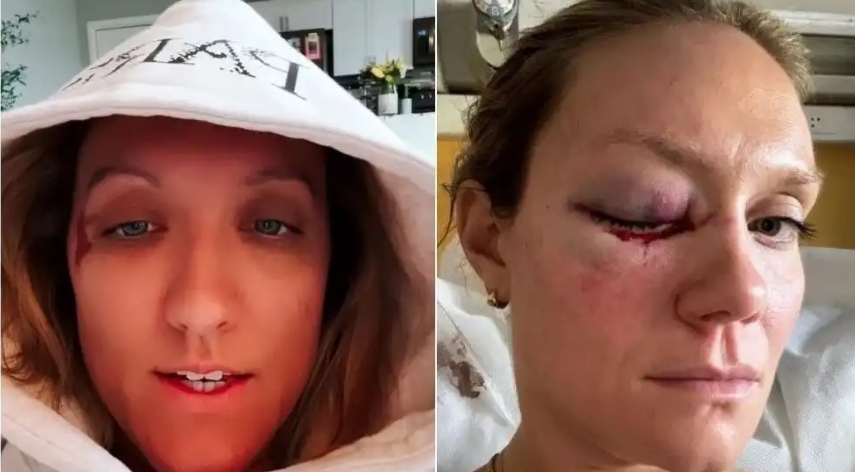 Atletas do vôlei feminino dos EUA sofrem acidente de carro em Paris