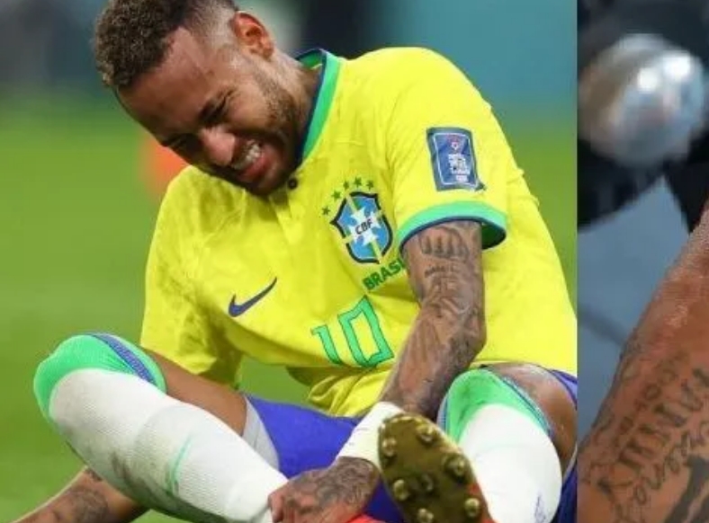 Neymar mostra cicatrizes após cirurgias e um ano sem jogar; 'Guerreiro'