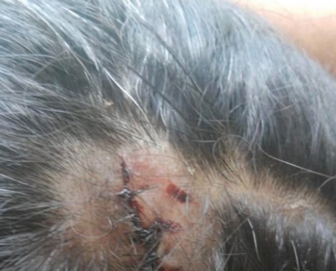 Funcionária de hotel é agredida com banco de madeira por hóspede no AM 