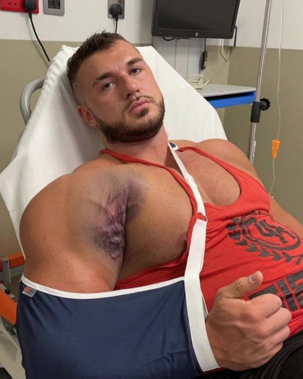 Fisiculturista tem peito rasgado durante treino na academia; Assista 