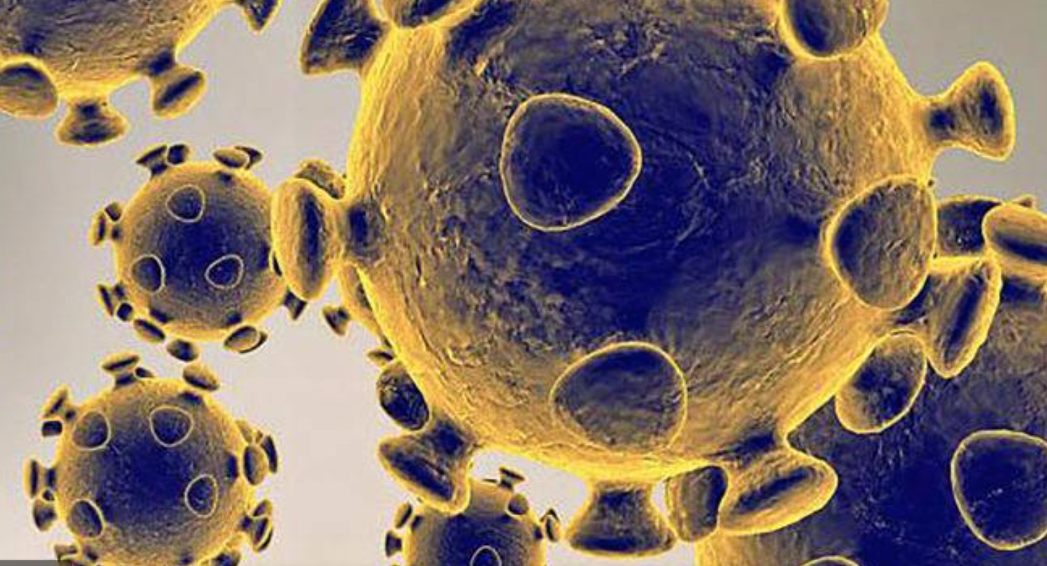 Governo deixou de gastar R$ 80 bi no combate à pandemia em 2020, diz estudo