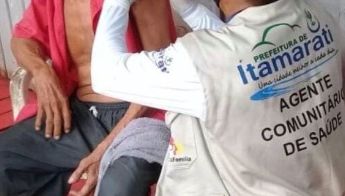 Promotoria recomenda substituição imediata de agentes de saúde no AM 