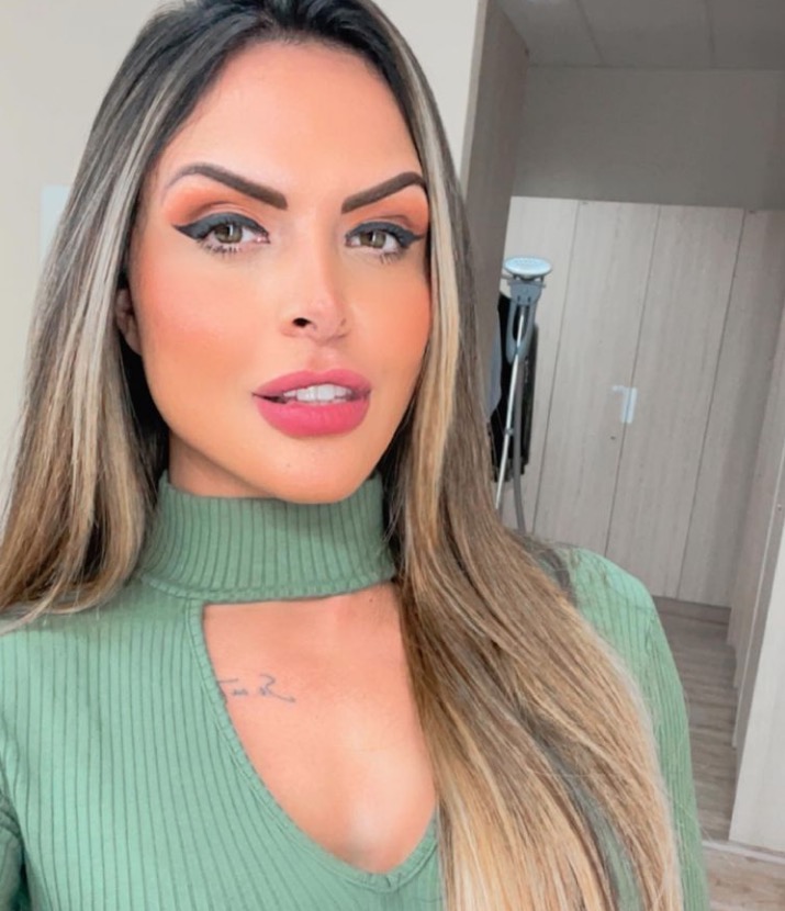 Apresentadora da Record agredida gasta R$ 20 mil para operar o rosto