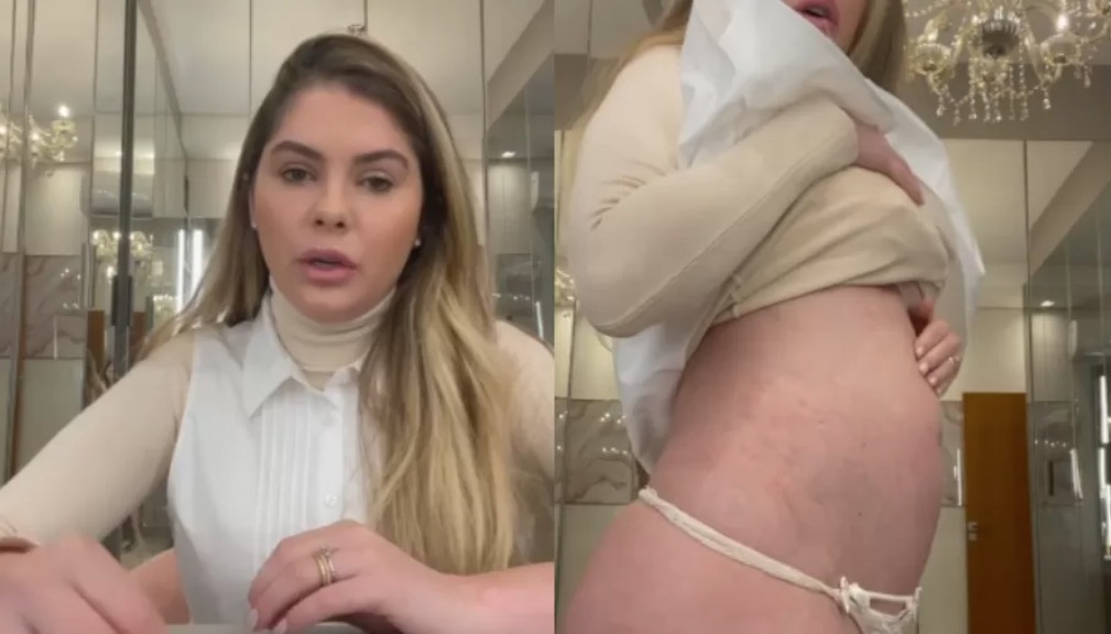 Bárbara Evans mostra corpo inchado em meio a tratamento de fertilização