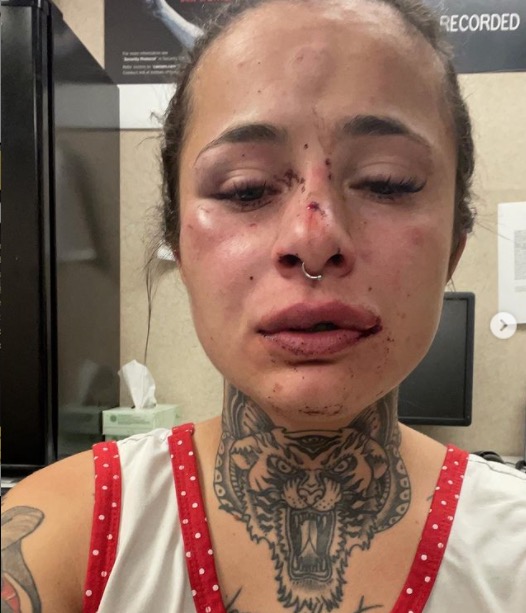 Tatuadora brasileira é agredida pelo namorado nos EUA e mostra hematomas