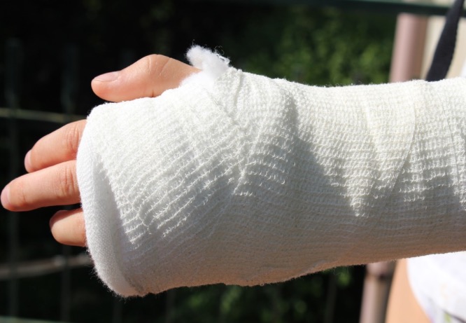 Mulher arranca parte do dedo da amante do marido durante briga