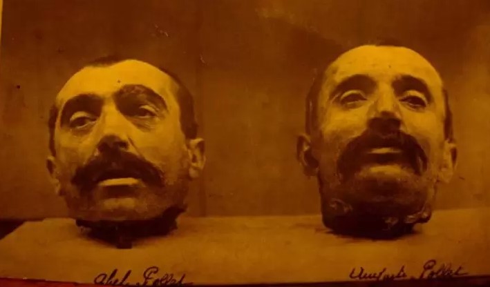 No século 18 pessoas acreditavam que cabeças decepadas expressavam raiva