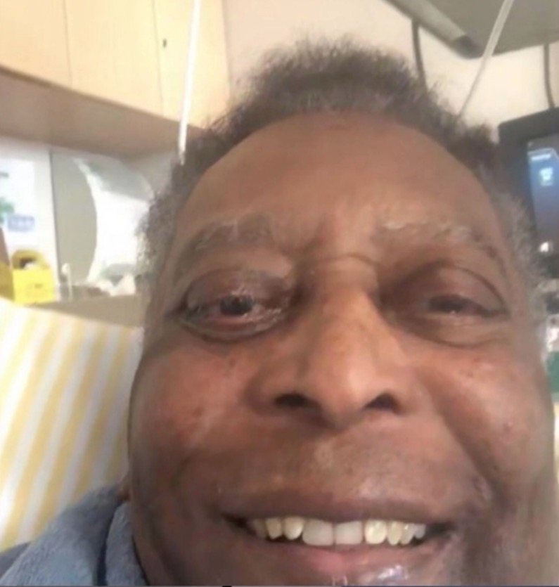 Pelé recebe alta da UTI após retirada de tumor no cólon