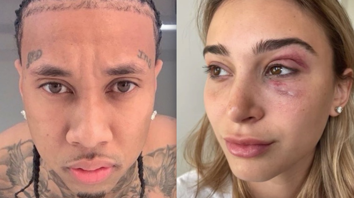Rapper Tyga é preso após ser acusado de agressão por ex-namorada 