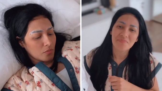 Simaria mostra processo para remover micropigmentação de sobrancelha