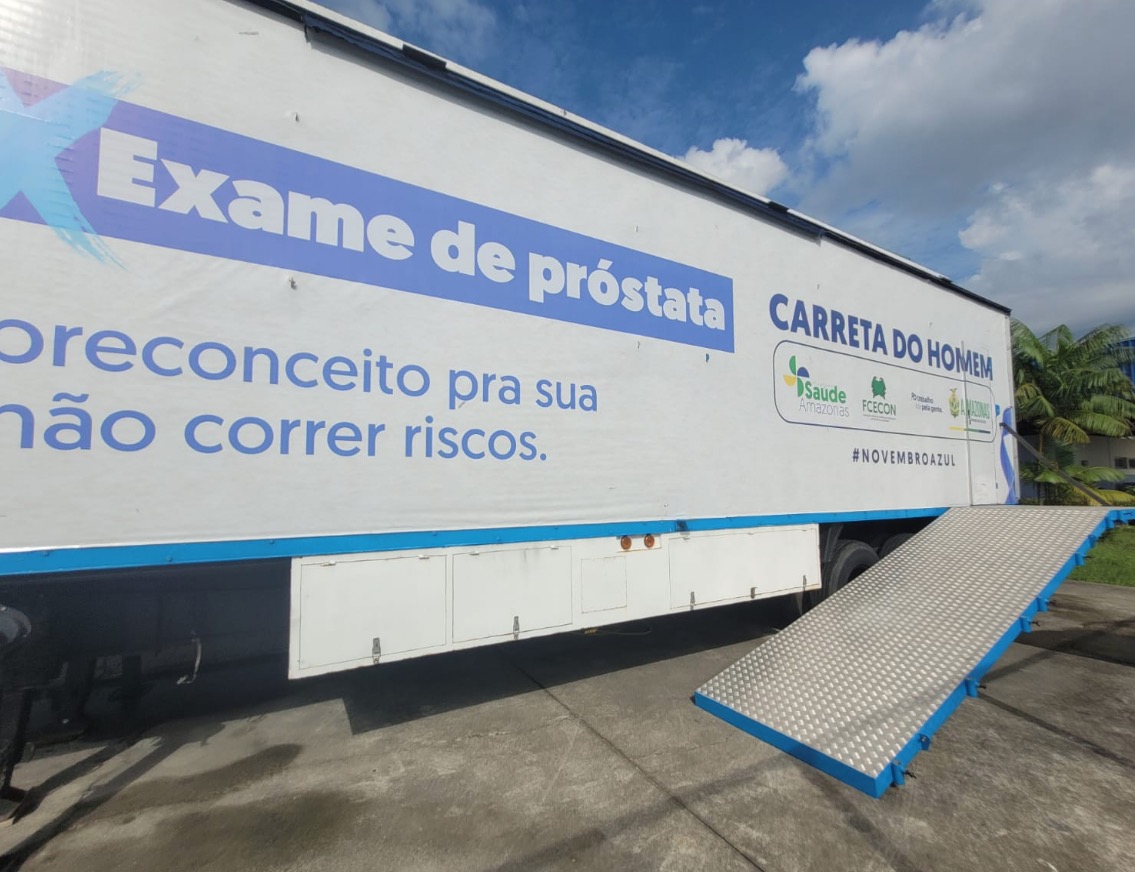 Carreta do Homem em Manaus atende pacientes agendados, alerta SES