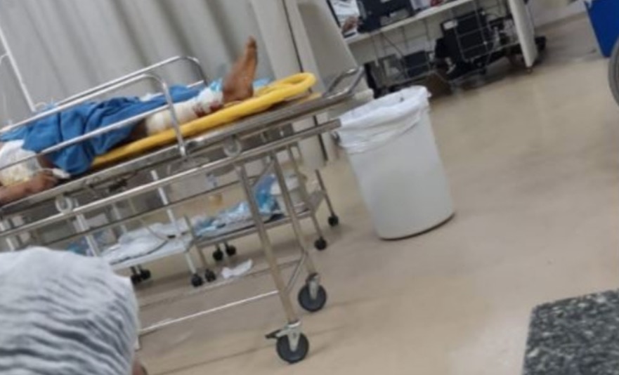 Adolescente tem pé decepado após atirar em mulher durante assalto no Amazonas