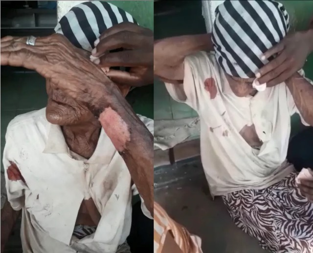 Idosa de 103 anos é espancada em assalto na BA
