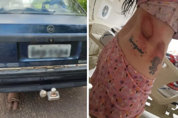 Mulher é amarrada em engate de carro pelo namorado e arrastada em estrada 