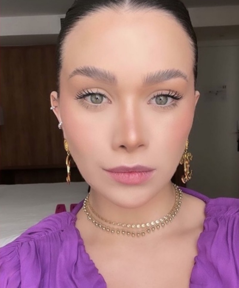 Flávia Pavanelli explica motivo de retirar preenchimento labial 