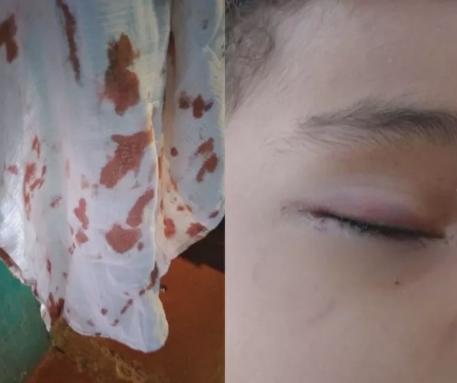 Criança de 3 anos  é atacada por rato enquanto dormia