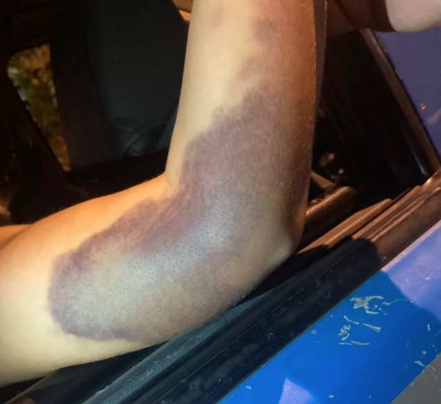 Jovem relata que foi estuprada e mantida em cárcere por sogros  