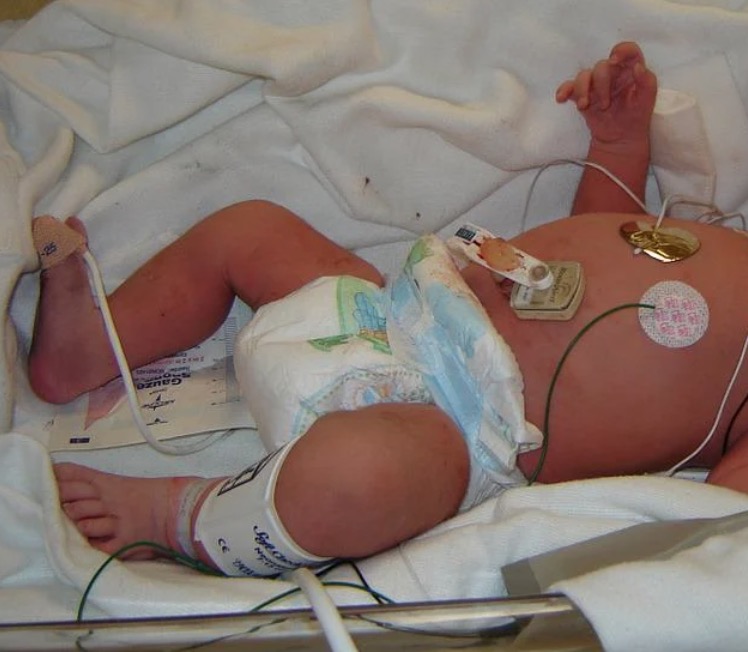 Sete casos de hepatite infantil misteriosa são investigados no Brasil 