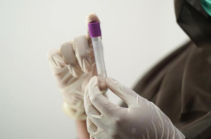 Nova linhagem da Ômicron presente nos EUA é detectada no Brasil